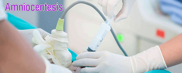 Amniocentesis en cucuta Ginecologo UNIFETUS5D