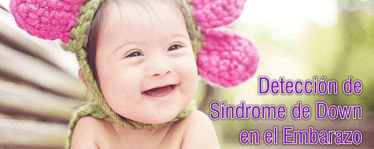 Deteccion sindrome de down en el embarazo Ginecologos UNIFETUS5D