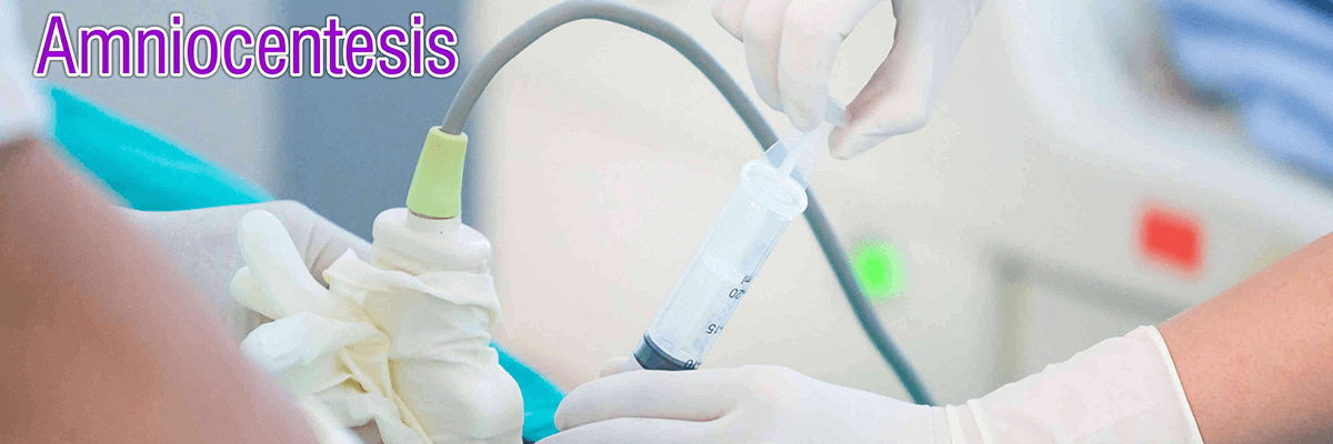 amniocentesis