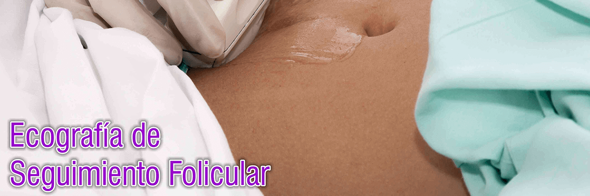 ecografia de seguimiento folicular