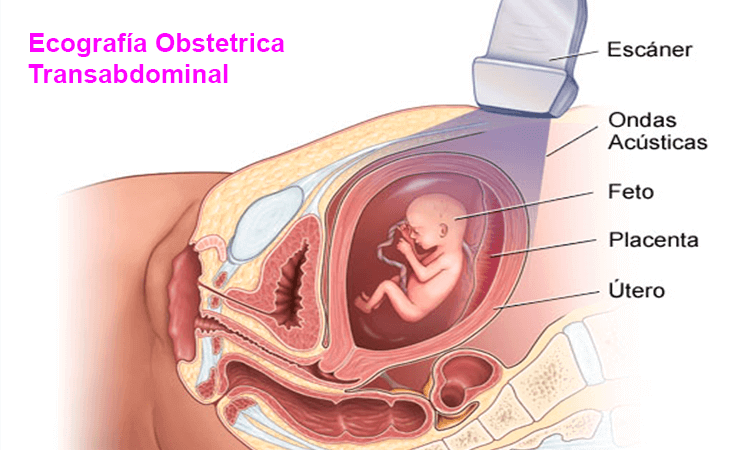 ecografia obstetrica transabdominal ginecologos cucuta Unifetus5D