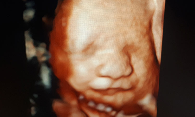 ecografias en cucuta