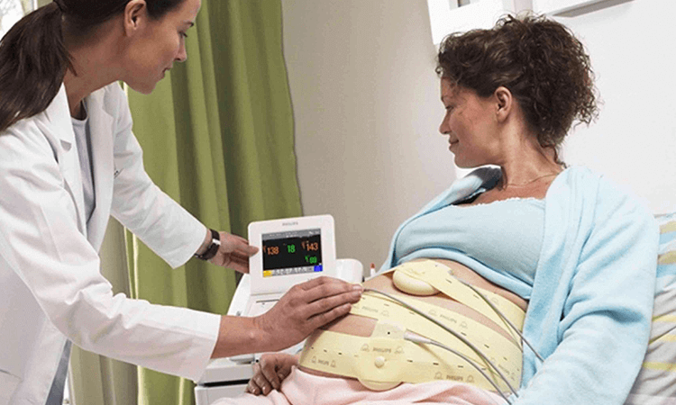 monitoria fetal sin estres